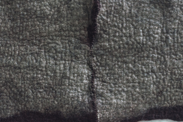 3-SuturedFiberB2013_600px